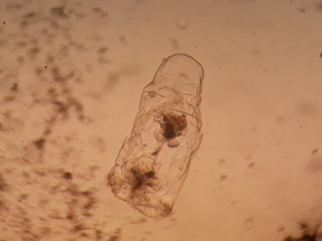 Asplanchna sp Asplanchna sp